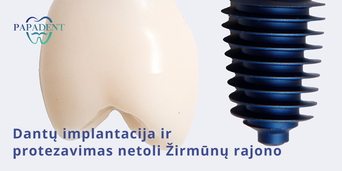 Dantų implantacija Žirmūnuose